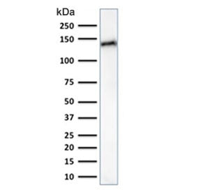 Western blot testing of human small intestine lysate with Cadherin 17 antibody (clone CDH17/2617). P