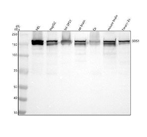 SOS1 Antibody / Son of sevenless 1, 100ul