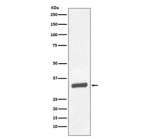 PSA / Prostate Specific Antigen Antibody