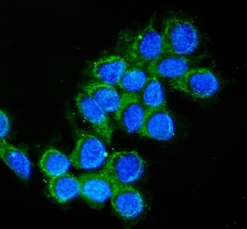 Cathepsin D Antibody