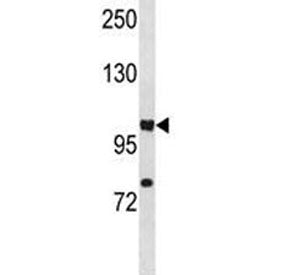 HIF1A antibody western blot analysis in A549 lysate. Routinely observed molecular weight: 100~120 kD