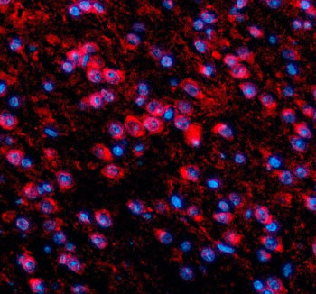 Immunofluorescent staining of TDP1 using anti-TDP1 antibody (red). TDP1 was detected in a paraffin-e