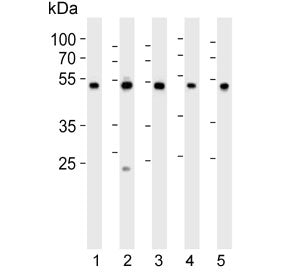 Western blot testing of 1) human K562, 2) human HepG2, 3) human HT-1080, 4) rat C6 and 5) human live