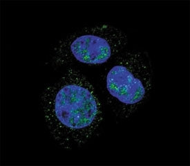 Confocal immunofluorescent analysis of p-Rb1 antibody with HepG2 cells followed by Alexa Fluor 488-c