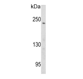 Western blot testing of human Ramos cell lysate with Pericentriolar material 1 protein antibody. Pre