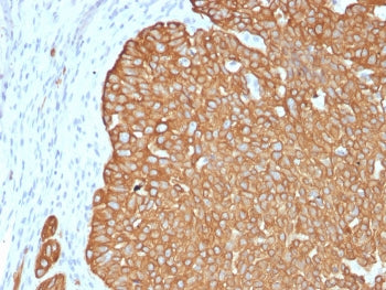 Cytokeratin 5 Antibody / KRT5