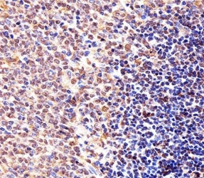 Cyclin B1 Antibody (CCNB1)