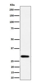 Western blot testing of human LnCaP cell lysate with N-acetyltransferase 1 antibody. Predicted molec