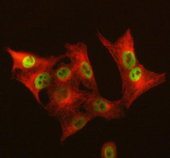 Immunofluorescent staining of GALNT12 using anti-GALNT12 antibody (green) and anti-Beta Tubulin anti