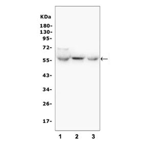 Western blot testing of rat 1) liver, 2) kidney and 3) lung tissue lysate with GLUT6 antibody. Predi