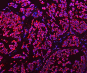 GDH1/2 Antibody / GLUD1/2