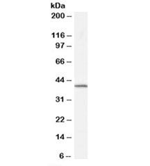 Western blot testing of human spleen lysate with Dysadherin antibody at 0.5ug/ml. Predicted molecula
