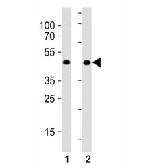 MyoD antibody western blot analysis in (1) HeLa cell line and (2) human placenta tissue lysate. Expe