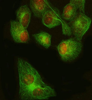 FOXP1 Antibody