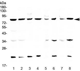 Western blot testing of human 1) HeLa, 2) MCF7, 3) COLO320, 4) U-87 MG, 5) rat brain, 6) rat liver, 
