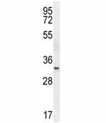 TTF-1 antibody western blot analysis in HeLa lysate.