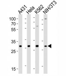 CDK5 Antibody