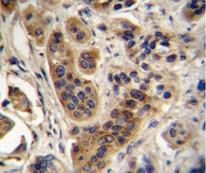ACOX1 Antibody / Peroxisomal acyl-coenzyme A oxidase 1