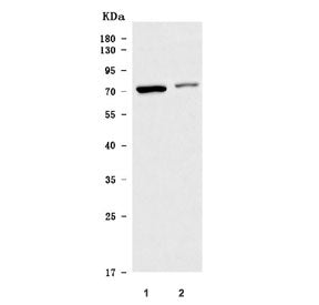 Western blot testing of huma 1) U-251 and 2) A431 cell lysate with TM9SF3 antibody. Predicted molecu