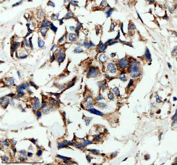 Immunofluorescent staining of HPGD using anti-HPGD antibody (green) and anti-Beta Tubulin antibody (