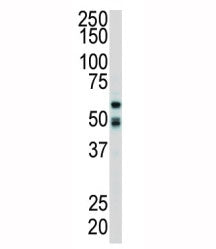 Western blot analysis of RIPK2 antibody and mouse cerebellum tissue lysate. Predicted molecular weig