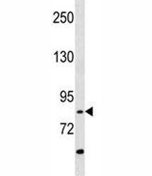 RIPK4 Antibody (ANKRD3)