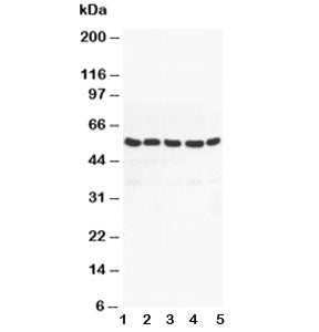 Western blot testing of PPAR gamma antibody and Lane 1: MM453; 2: MM231; 3: HeLa; 4: Jurkat; 5: HT10