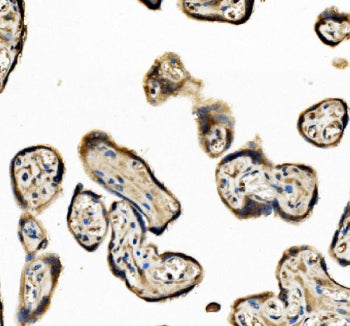 EIF3D Antibody / Eukaryotic translation initiation factor 3 subunit D, 100ug