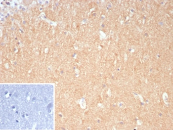 IHC staining of FFPE human brain tissue with DLL3 antibody (clone DLL3/9361). Inset: PBS used in pla