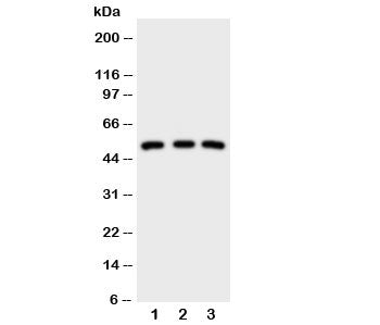 Western blot testing of IRAK antibody; Lane 1: HeLa; 2: U87; 3: MCF-7 cell lysate. Expected/observed