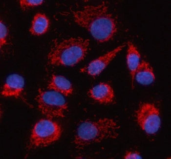 Immunofluorescent staining of FFPE human A549 cells with HDGFL2 antibody (red) and DAPI nuclear stai