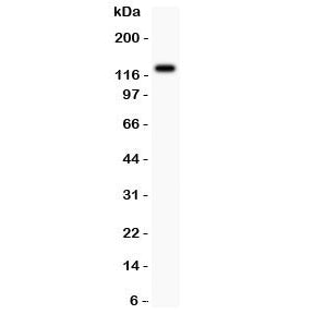 Western blot testing of TIE2 antibody and MCF-7 lysate; Predicted molecular weight: ~126 kDa but may