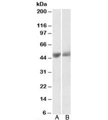 Western blot testing of human albumin-depleted plasma [A] and serum [B] lysates with PEDF antibody a