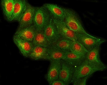 Immunofluorescent staining of FFPE human U-2 OS cells with PRPF4 antibody (red) and Beta Tubulin mAb
