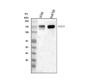Western blot analysis of GLI1 using anti-GLI1 antibody. Lane 1: rat brain tissue lysates, Lane 2: mo