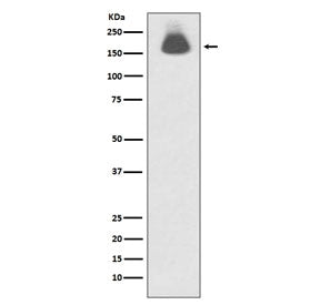 Western blot testing of lysate from human A431 cells treated with EGF with phospho-EGFR antibody. Ex