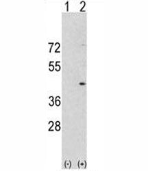 Western blot analysis of Aurora-A antibody and 293 cell lysate either nontransfected (Lane 1) or tra