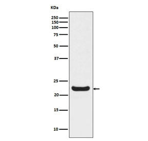 Western blot testing of human HepG2 cell lysate with RBP4 antibody. Predicted molecular weight ~23 k