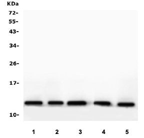 Western blot testing of human 1) HeLa, 2) K562, 3) ThP-1, 4) U-2 OS and 5) U-87 MG cell lysate with 