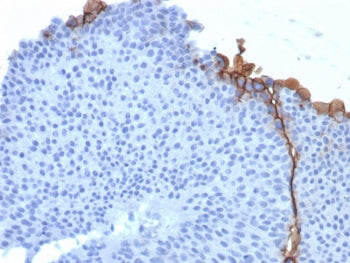 IHC staining of FFPE human bladder tissue with UPK3B antibody (clone UPK3B/3270). HIER: boil tissue 