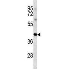 Anti-Oct4 antibody western blot analysis in K562 lysate. Predicted molecular weight ~38/30kDa (isofo