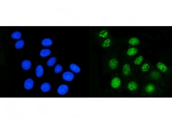 DHODH Antibody