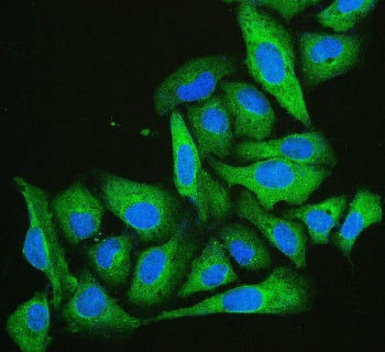 Immunofluorescent staining of FFPE human U-2 OS cells with Cofilin 2 antibody (green) and DAPI (blue