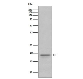 Western blot testing of human fetal brain lysate with Myelin Basic Protein antibody. Expected molecu
