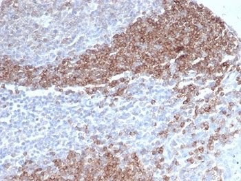 CD79b Antibody