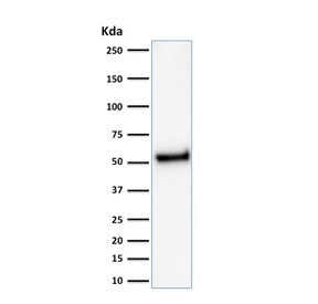 Western blot testing of human HeLa cell lysate with recombinant p53 antibody (clone rTP53/1739). Exp