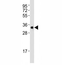 Atg5 Antibody