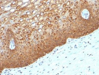 Cytokeratin 14 Antibody / CK14 / KRT14