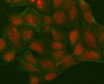 Immunofluorescent staining of FFPE human A549 cells with NUDT15 antibody (red) and Phalloidin-iFluor