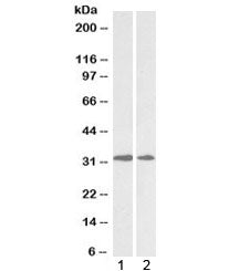 Western blot testing of human 1) heart and 2) placenta lysate with LOX antibody at 0.5ug/ml. Expecte